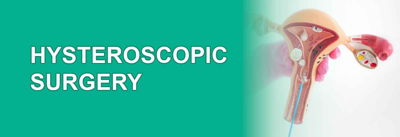 hysteroscopic